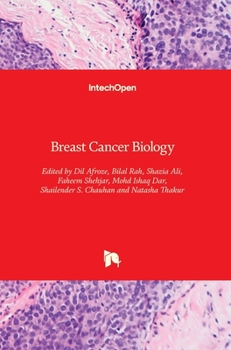Hardcover Breast Cancer Biology Book