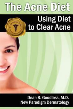 Paperback The Acne Diet: Using Diet to Clear Acne Book