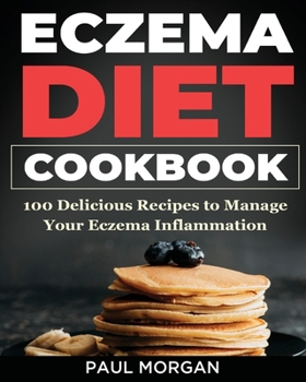 Paperback Eczema DIet Cookbook: 100 Delicious Recipes to Manage your Eczema Inflammation Book