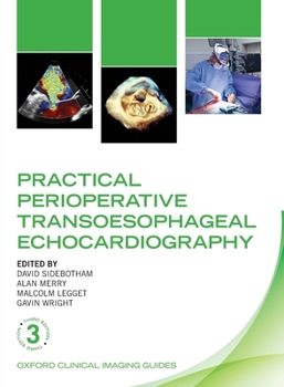 Paperback Practical Perioperative Transoesophageal Echocardiography Book