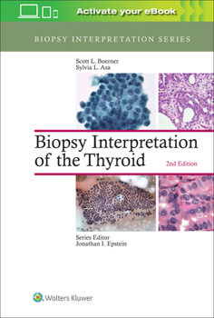 Hardcover Biopsy Interpretation of the Thyroid Book