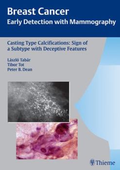 Hardcover Casting Type Calcifications: Sign of a Subtype With Deceptive Features (Breast Cancer: Early Detection With Mammography) Book