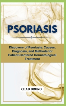 Paperback Psoriasis: Discovery of Psoriasis: Causes, Diagnosis, and Methods for Patient-Centered Dermatological Treatment Book