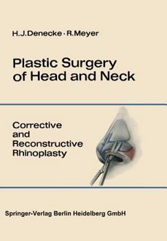 Paperback Plastic Surgery of Head and Neck: Volume I: Corrective and Reconstructive Rhinoplasty Book