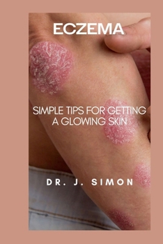 Paperback Eczema: Simple Tips for Getting a Glowing Skin Book