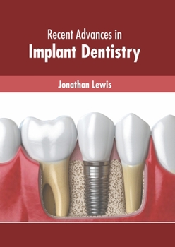 Hardcover Recent Advances in Implant Dentistry Book