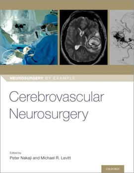 Paperback Cerebrovascular Neurosurgery Book