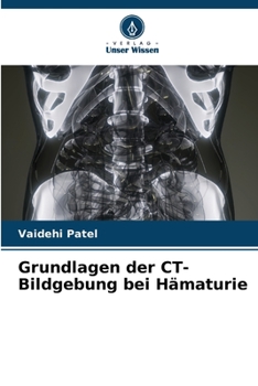 Paperback Grundlagen der CT-Bildgebung bei Hämaturie [German] Book