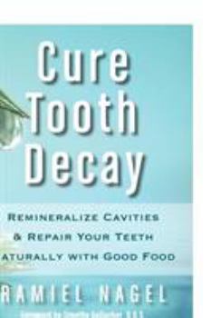 Paperback Cure Tooth Decay: Remineralize Cavities and Repair Your Teeth Naturally with Good Food Book