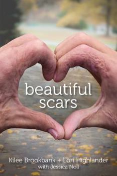 Paperback Beautiful Scars Book