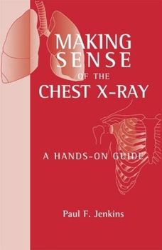 Paperback Making Sense of the Chest X-Ray: A Hands-On Guide Book
