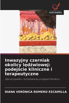 Inwazyjny czerniak okolicy ledzwiowej: podejscie kliniczne i terapeutyczne (Polish Edition)