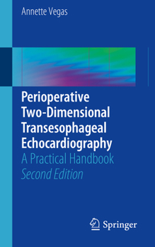 Paperback Perioperative Two-Dimensional Transesophageal Echocardiography: A Practical Handbook Book