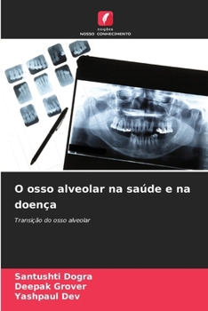 Paperback O osso alveolar na saúde e na doença [Portuguese] Book