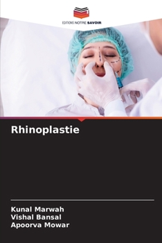 Paperback Rhinoplastie [French] Book