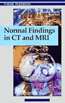 Paperback Normal Findings in CT and Mri, A1, Print Book