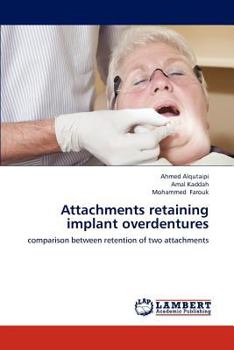 Paperback Attachments retaining implant overdentures Book