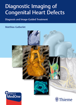 Hardcover Diagnostic Imaging of Congenital Heart Defects: Diagnosis and Image-Guided Treatment Book