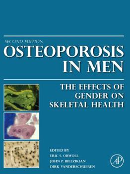 Hardcover Osteoporosis in Men: The Effects of Gender on Skeletal Health Book