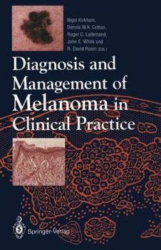 Paperback Diagnosis and Management of Melanoma in Clinical Practice Book