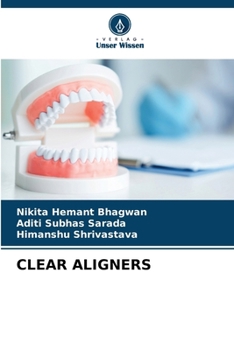 Paperback Clear Aligners [German] Book