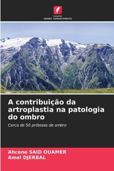 A contribuição da artroplastia na patologia do ombro: Cerca de 50 próteses de ombro (Portuguese Edition)