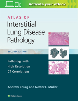 Hardcover Atlas of Interstitial Lung Disease Pathology Book