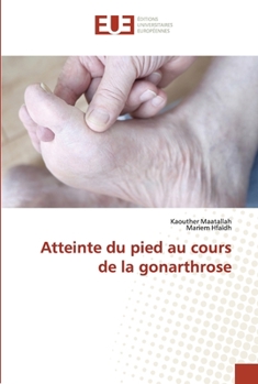 Paperback Atteinte du pied au cours de la gonarthrose [French] Book