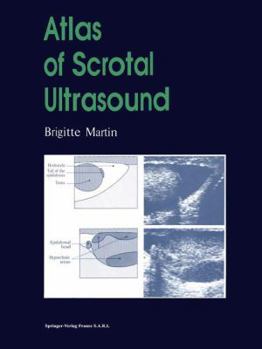 Paperback Atlas of Scrotal Ultrasound Book