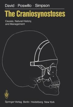 Paperback The Craniosynostoses: Causes, Natural History, and Management Book