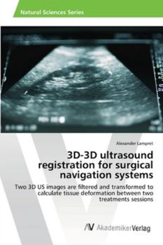 Paperback 3D-3D ultrasound registration for surgical navigation systems Book