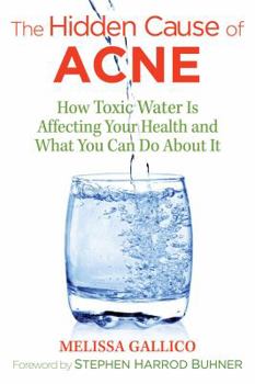Paperback The Hidden Cause of Acne: How Toxic Water Is Affecting Your Health and What You Can Do about It Book