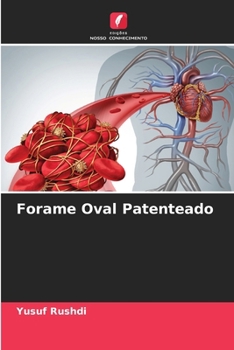 Paperback Forame Oval Patenteado [Portuguese] Book