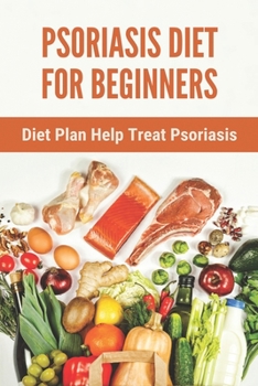 Paperback Psoriasis Diet For Beginners: Diet Plan Help Treat Psoriasis: Psoriasis Ayurvedic Treatment Diet Book