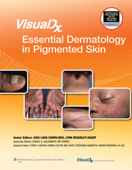 Hardcover Visualdx: Essential Dermatology in Pigmented Skin Book