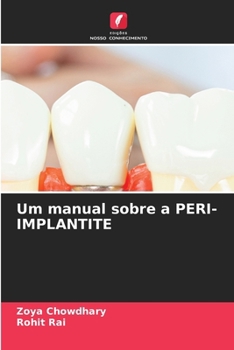 Paperback Um manual sobre a PERI-IMPLANTITE [Portuguese] Book