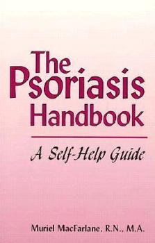 Paperback The Psoriasis Handbook: A Self-Help Guide Book