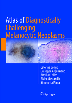 Paperback Atlas of Diagnostically Challenging Melanocytic Neoplasms Book