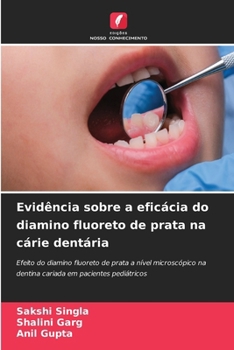 Paperback Evidência sobre a eficácia do diamino fluoreto de prata na cárie dentária [Portuguese] Book