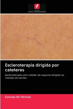 Paperback Escleroterapia dirigida por cateteres [Portuguese] Book