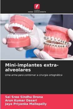 Paperback Mini-implantes extra-alveolares [Portuguese] Book