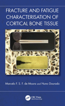 Hardcover Fracture and Fatigue Characterisation of Cortical Bone Tissue Book