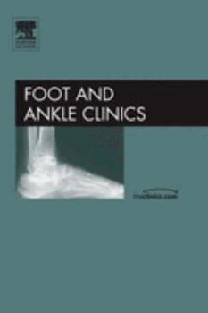 Hardcover Surgery of the Hallux, an Issue of Foot and Ankle Clinics: Volume 10-1 Book