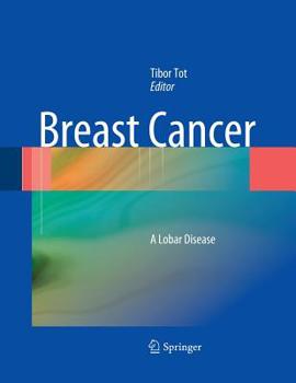 Paperback Breast Cancer: A Lobar Disease Book