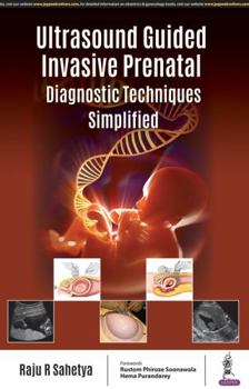 Paperback Ultrasound Guided Invasive Prenatal Diagnostic Techniques Simplified Book