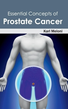 Hardcover Essential Concepts of Prostate Cancer Book