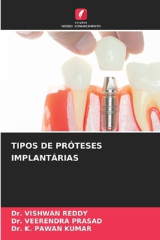 Tipos de Próteses Implantárias (Portuguese Edition)