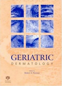 Hardcover Geriatric Dermatology Book