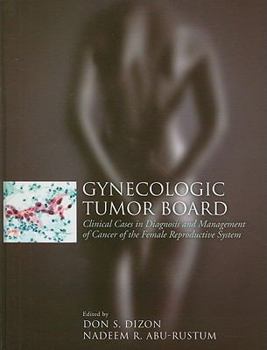 Hardcover Gynecologic Tumor Board: Clinical Cases in Diagnosis and Management of Cancer of the Female Reproductive System Book