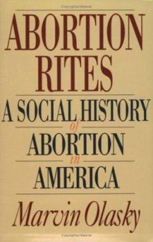 Paperback Abortion Rites: A Social History of Abortion in America Book